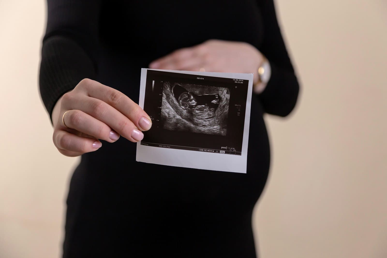 A pregnant woman in a black dress holds a printed ultrasound picture of her baby in front of her bump